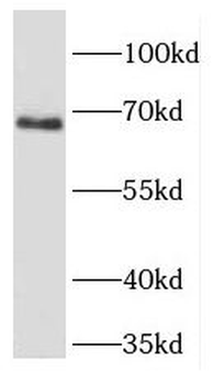 FIGNL1 Rabbit Polyclonal Antibody