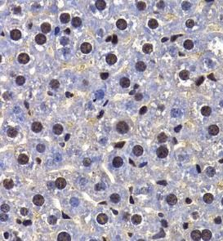 FIP1L1 Antibody