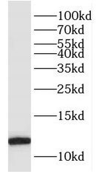FKBP1B Rabbit Polyclonal Antibody