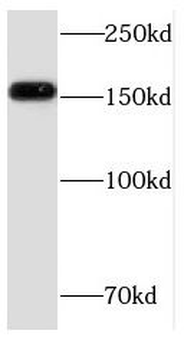 FMN1 Rabbit Polyclonal Antibody
