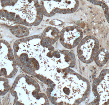 FMN2 Rabbit Polyclonal Antibody