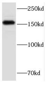 FMNL1 Rabbit Polyclonal Antibody