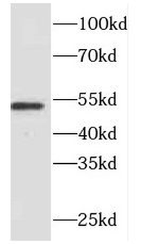 FMO2 Rabbit Polyclonal Antibody