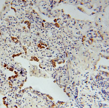 FMO2 Rabbit Polyclonal Antibody