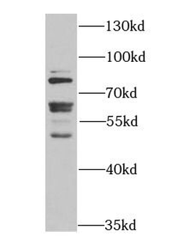 FMR1 Antibody