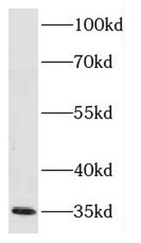 FN3K Rabbit Polyclonal Antibody