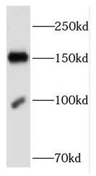 FNDC3B Rabbit Polyclonal Antibody
