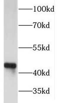 FNTA Rabbit Polyclonal Antibody