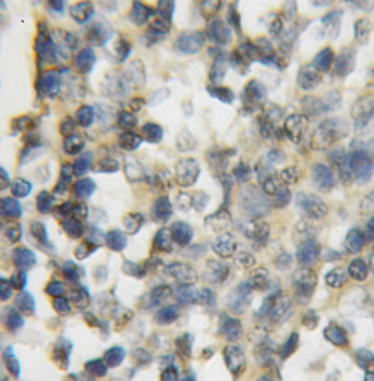 FNTB Rabbit Polyclonal Antibody