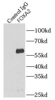 FOXA2 Rabbit Polyclonal Antibody