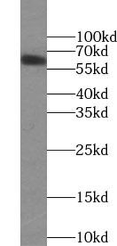FOXA2 Rabbit Polyclonal Antibody
