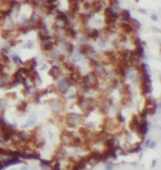 FOXA2 Rabbit Polyclonal Antibody