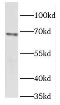 FOXJ3 Rabbit Polyclonal Antibody