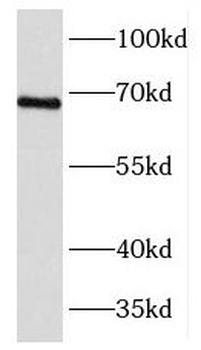 FOXJ3 Rabbit Polyclonal Antibody