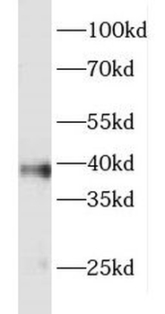 FOXR2 Rabbit Polyclonal Antibody