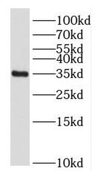FOXS1 Rabbit Polyclonal Antibody