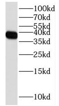 FPGT Rabbit Polyclonal Antibody