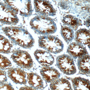 FPGT Rabbit Polyclonal Antibody