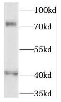 FREM1 Rabbit Polyclonal Antibody