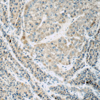 FREM1 Rabbit Polyclonal Antibody