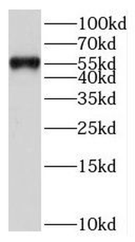 FRK Rabbit Polyclonal Antibody