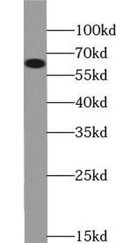 FRS2 Rabbit Polyclonal Antibody