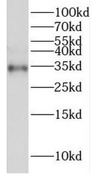 FRZB Rabbit Polyclonal Antibody