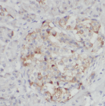 FRZB Rabbit Polyclonal Antibody