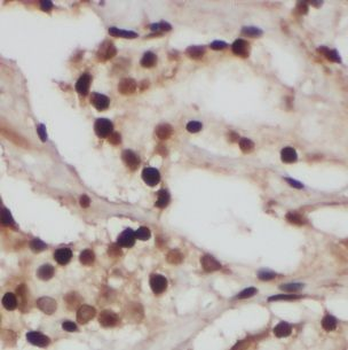 FUBP3 Rabbit Polyclonal Antibody