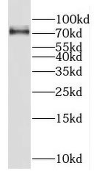 FUS Rabbit Polyclonal Antibody
