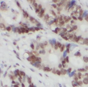 FUS Rabbit Polyclonal Antibody