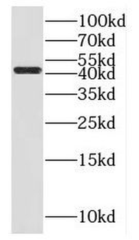 FUT10 Rabbit Polyclonal Antibody