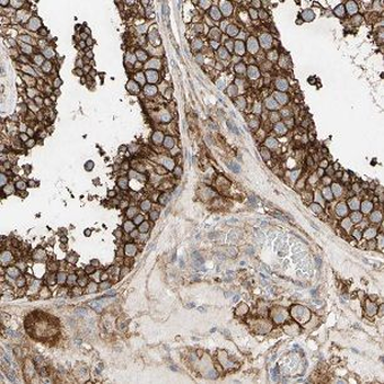 FUT10 Rabbit Polyclonal Antibody