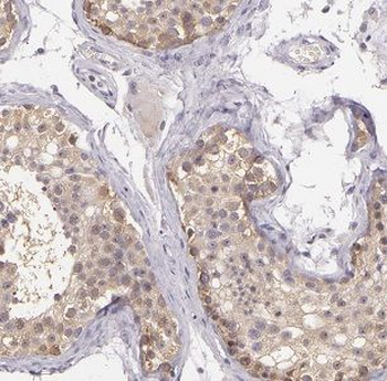 FUT11 Rabbit Polyclonal Antibody