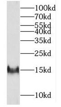 FXN Rabbit Polyclonal Antibody