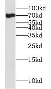 FXR1 Rabbit Polyclonal Antibody