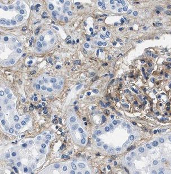 FXR1 Rabbit Polyclonal Antibody