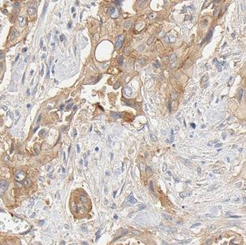 FXYD2 Rabbit Polyclonal Antibody