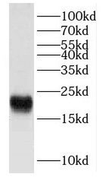 FXYD6 Rabbit Polyclonal Antibody