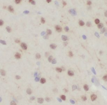 FXYD6 Rabbit Polyclonal Antibody