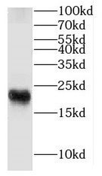 FXYD7 Rabbit Polyclonal Antibody