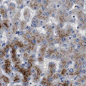 G6PC3 Rabbit Polyclonal Antibody