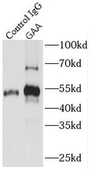 GAA Rabbit Polyclonal Antibody