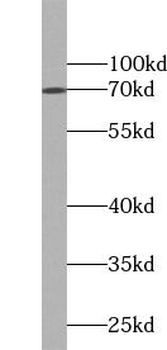 GAA Rabbit Polyclonal Antibody