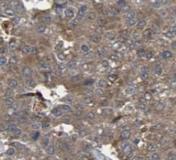 GAA Rabbit Polyclonal Antibody