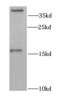 GABARAP Antibody