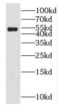 GABRB1 Rabbit Polyclonal Antibody
