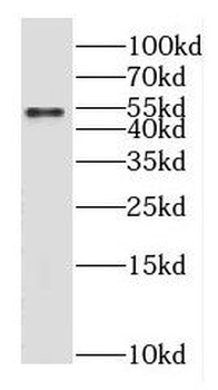 GABRG1 Rabbit Polyclonal Antibody