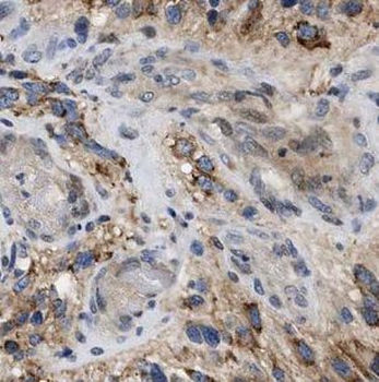 GABRG1 Rabbit Polyclonal Antibody