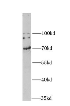 GAD2 Rabbit Polyclonal Antibody